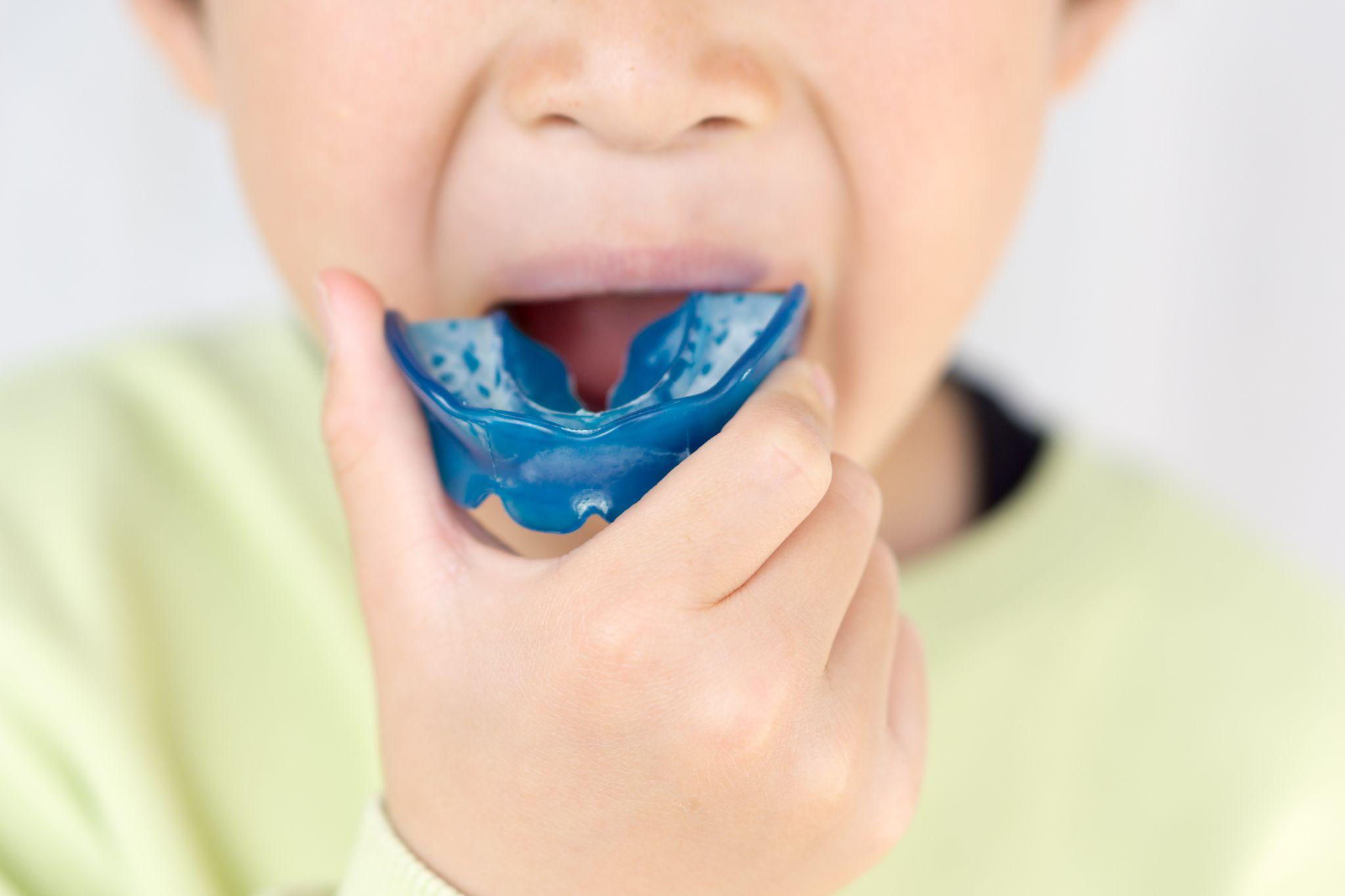 【1期治療】小児矯正の費用相場