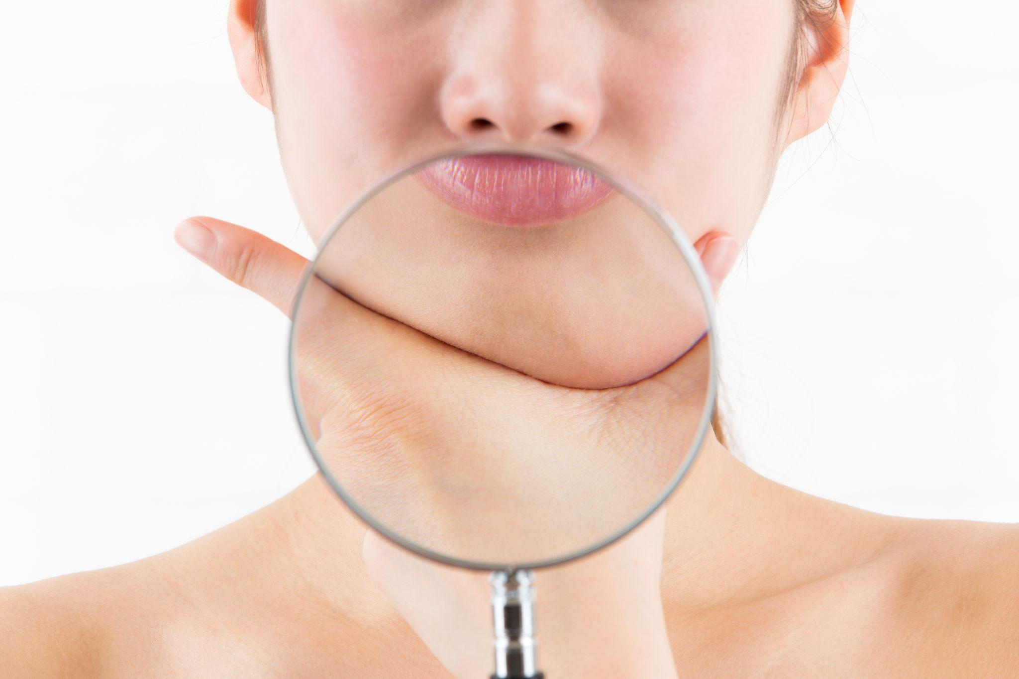 手術が必要な受け口とは