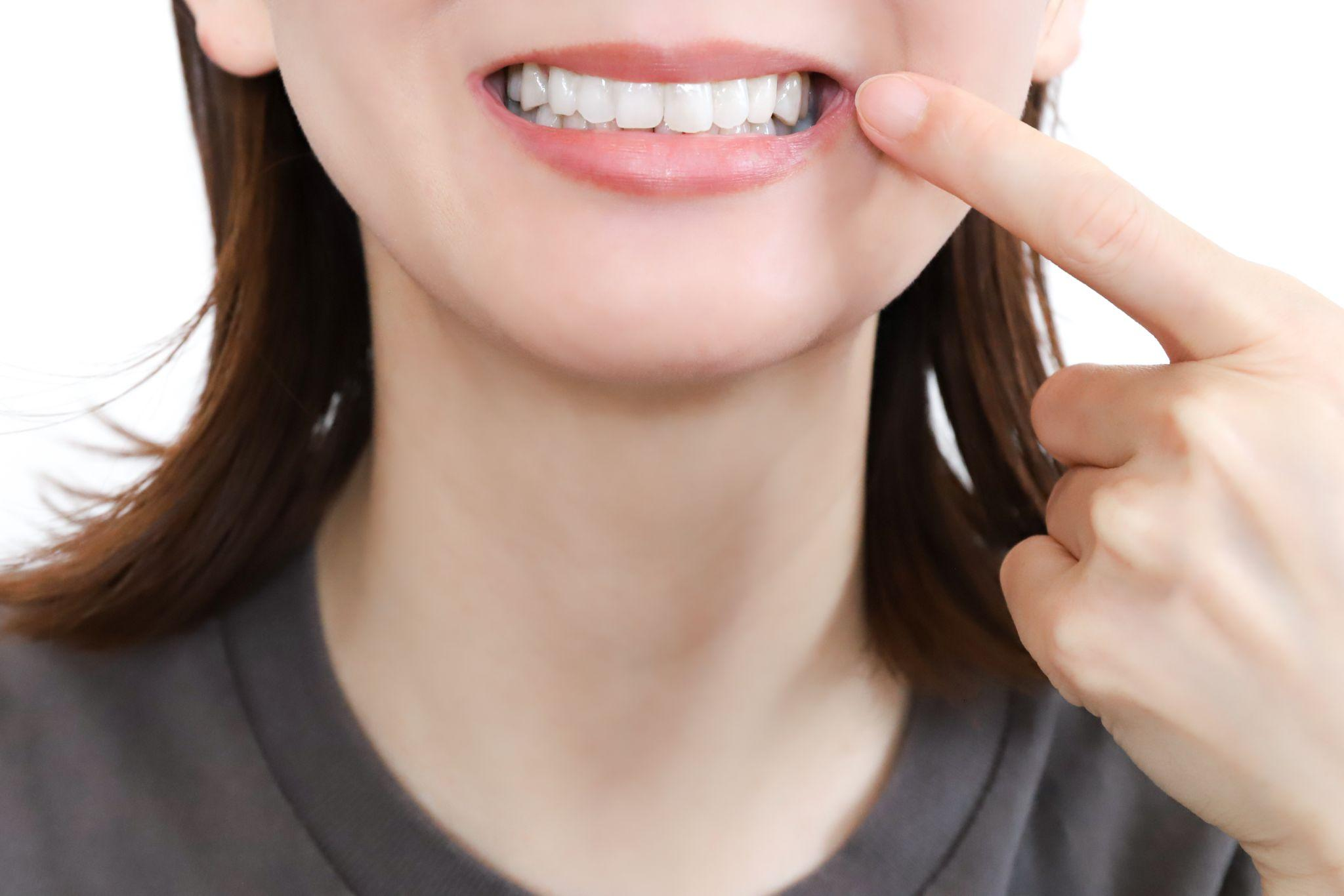 歯列矯正とホワイトニングを同時に行う場合の注意点